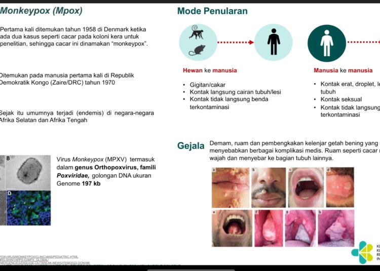 Waspada Penularan MPOX